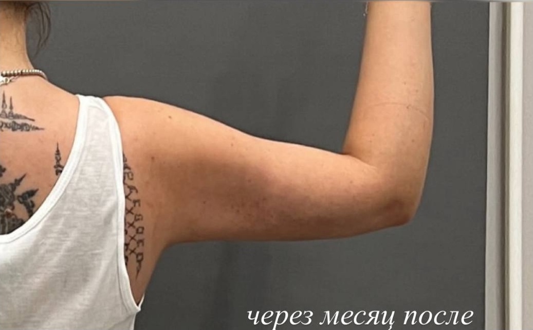 После